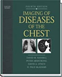 Imaging of Diseases of the Chest