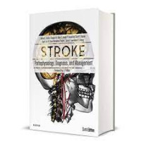 Stroke Pathophysiology, Diagnosis, and Management